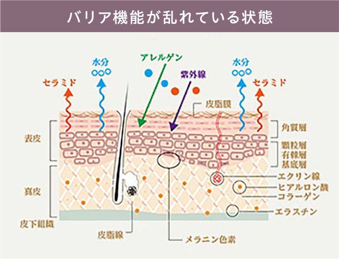 バリア機能が乱れている状態